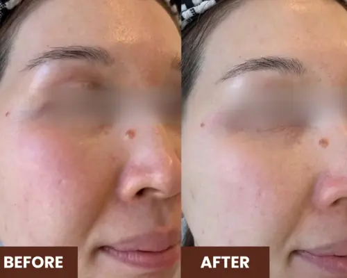 90 นาที Embellir Anti-Aging Facial ที่ Ikeda Spa ใน Bukit Timah | สัมผัสศิลปะแห่งสปาแบบญี่ปุ่นในสิงคโปร์