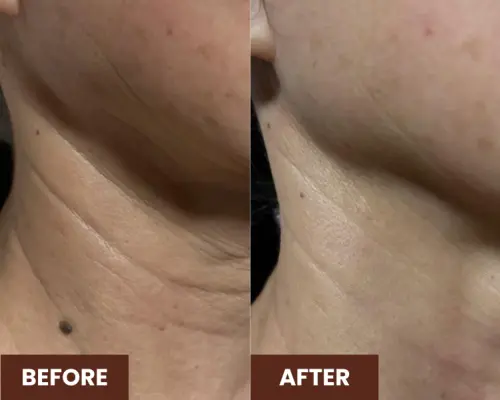 90 นาที Embellir Anti-Aging Facial ที่ Ikeda Spa ใน Bukit Timah | สัมผัสศิลปะแห่งสปาแบบญี่ปุ่นในสิงคโปร์