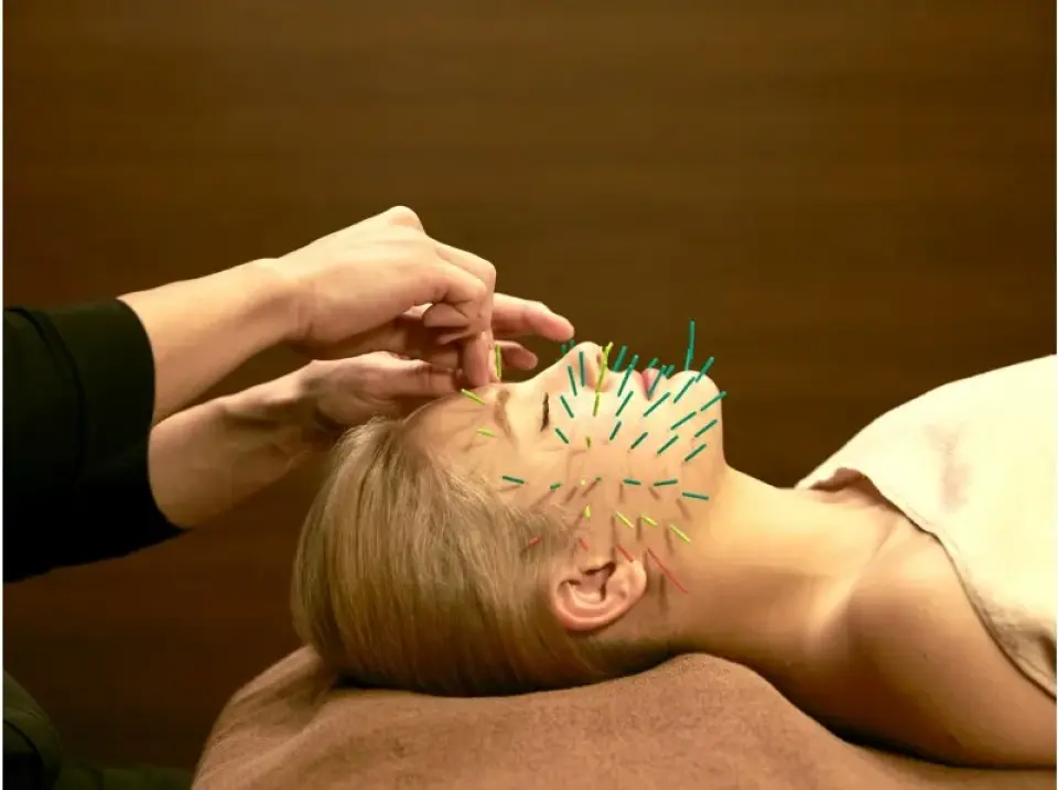⑥〈Treatment〉 Hedgehog cosmetic acupuncture. It uses over 80 needles to make your face smaller.